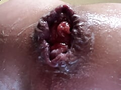 Stretched out anal ass cum